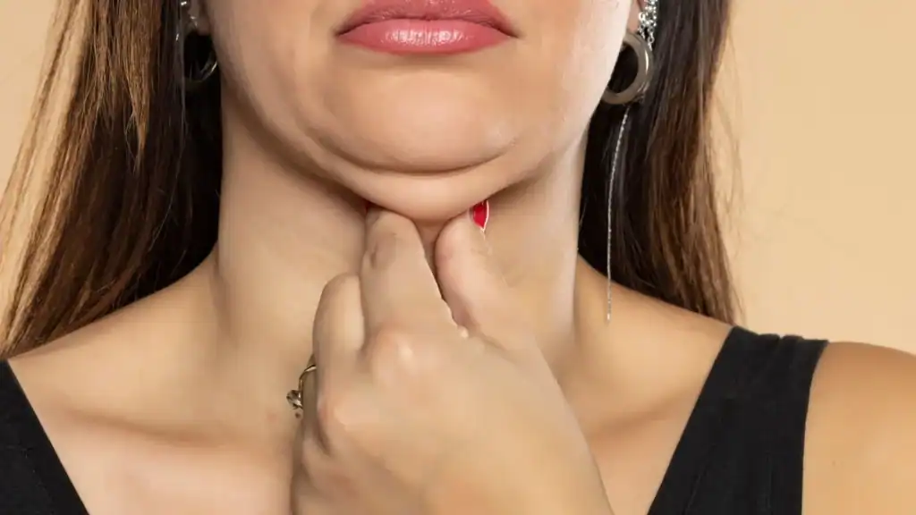 An image of a woman with double chin, sad, worried : Non Surgical Double Chin Removal Treatment in Preston, UK