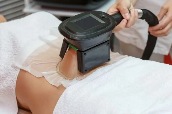 Image of person having fat freezing treatment to help weight gain Preston