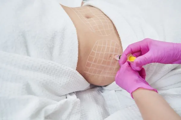 image of fat dissolving injections on love handles to help combat weight gain Preston
