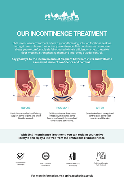 image of how urge incontinence Preston treatment works