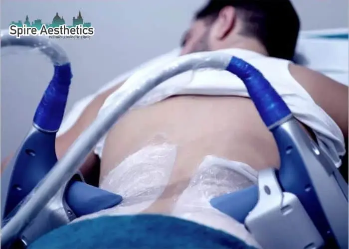 Man having fat freezing treatment done on love handles before a competitions Preston to create a sculpted look.